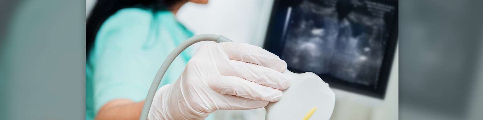 Ultrasound equipment for OBGYN