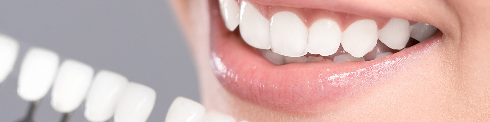 8 Tips for Marketing Whitening in Your Practice