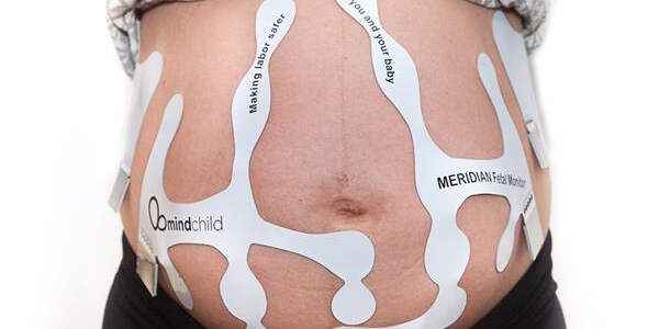 Parche de electrodos desechable MERIDIAN M110: Henry Schein Medical