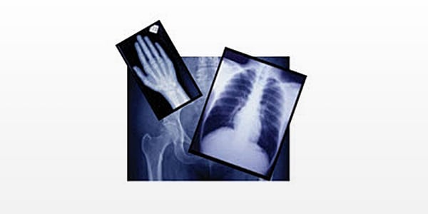 Consumibles para radiograf&iacute;as de la marca Henry Schein, Henry Schein Medical